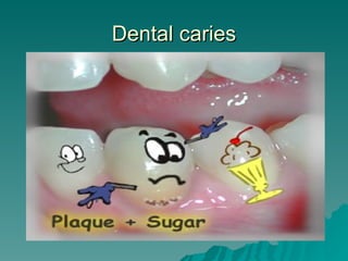 Dental caries 