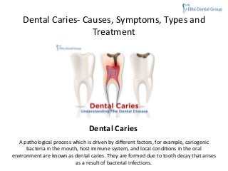 Dental Caries- Causes, Symptoms, Types and
Treatment
Dental Caries
A pathological process which is driven by different factors, for example, cariogenic
bacteria in the mouth, host immune system, and local conditions in the oral
environment are known as dental caries. They are formed due to tooth decay that arises
as a result of bacterial infections.
 