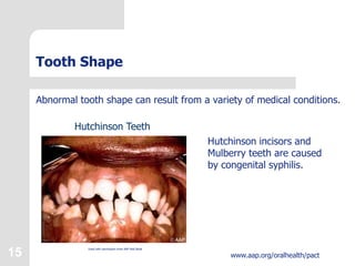 Dental -Development .ppt