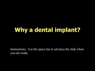 Why a dental implant? Instructions:  Use the space bar to advance the slide when you are ready. 