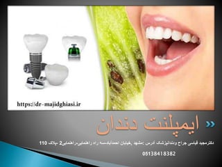 ‫ودندانپزشک‬ ‫جراح‬ ‫قیاسی‬ ‫دکترمجید‬‫آدرس‬:‫مشهد‬,‫احمدآباد‬ ‫خیابان‬-‫راهنمایی‬ ‫راه‬ ‫سه‬-‫راهنمایی‬2-‫پالک‬110
‫دندان‬ ‫ایمپلنت‬
05138418382
 