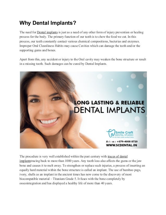 Dental Implants in Ahmedabad Best Dentist in Ahmedabad Best Dental