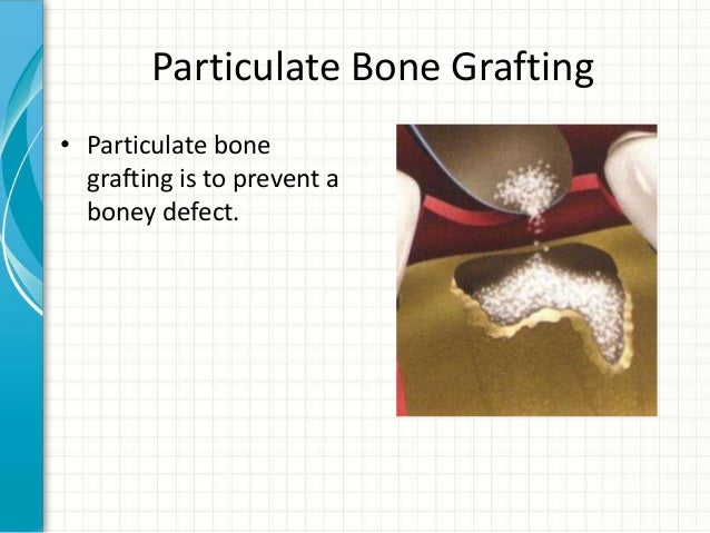 how-to-select-a-dental-implant-specialist-by-piney-point-oms-12-638.jpg?cb=1375781848