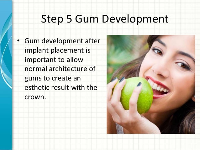 how-to-select-a-dental-implant-specialist-by-piney-point-oms-17-638.jpg?cb=1375781848