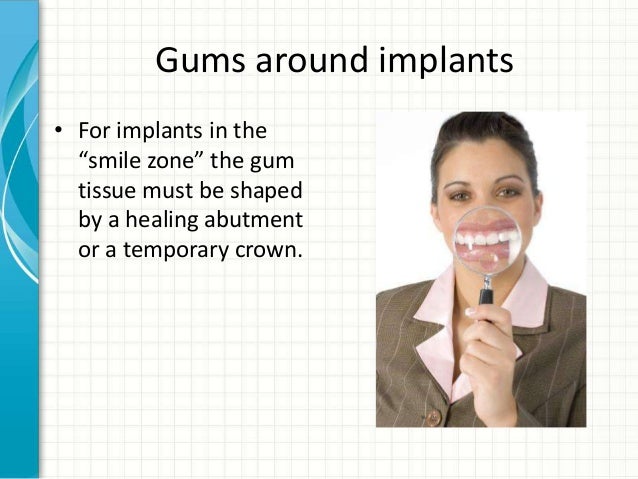 how-to-select-a-dental-implant-specialist-by-piney-point-oms-18-638.jpg?cb=1375781848