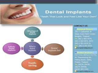 Advantages of
               Dental
              Implants




 Esthetic     What is
  Dental      dental          Dental
Implants     implants.      implants feel




             Tooth-
             saving
 