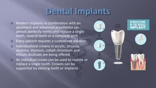  Modern implants in combination with an
abutment and advanced prosthetics can
almost perfectly mimic and replace a single...