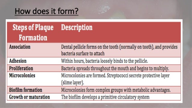 dental plaque explained how does plaque form