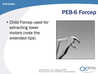PEB-6 Forcep 
• 
Child Forcep used for extracting lower molars (note the extended tips) 
Extraction  