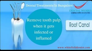 Dental Treatments In Bangalore
 
