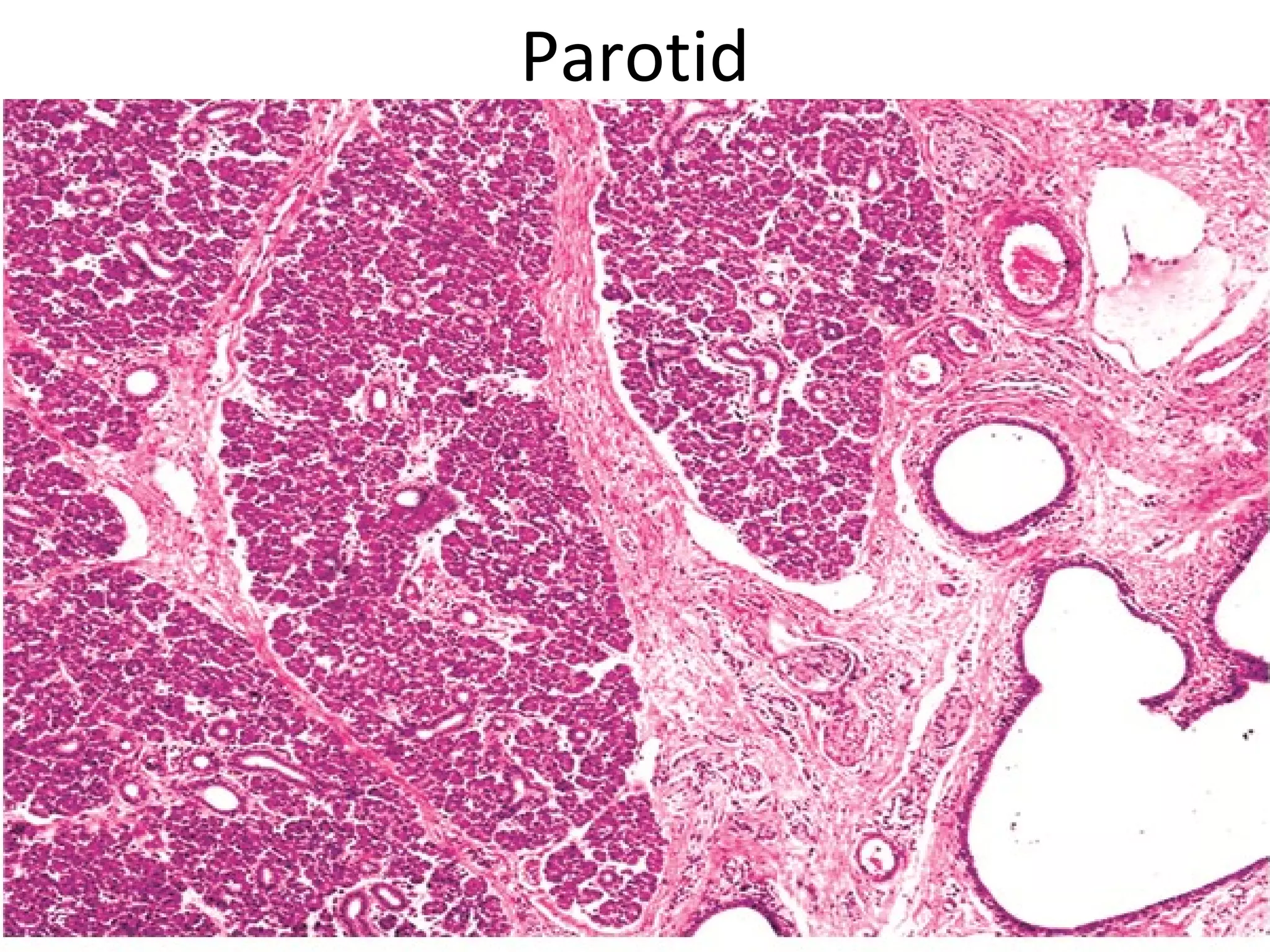 Parotid