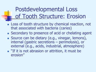 Postdevelopmental Loss
of Tooth Structure: Erosion
 Loss of tooth structure by chemical reaction, not
that associated with bacteria (caries)
 Secondary to presence of acid or chelating agent
 Source can be dietary (e.g., vinegar, lemons),
internal (gastric secretions – perimolysis), or
external (e.g., acids, industrial, atmosphere)
 “If it is not abrasion or attrition, it must be
erosion”
 