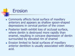Erosion
 Commonly affects facial surface of maxillary
anteriors and appears as shallow spoon-shaped
depressions in cervical portion of the crown
 Posterior teeth exhibit loss of occlusal surface,
where dentin is destroyed more rapidly than
enamel, resulting in concave depression of dentin
surrounded by elevated rim of enamel
 Erosion limited to facial surfaces of maxillary
anterior dentition is usually associated with dietary
acid.
 