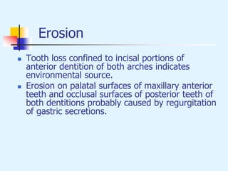 Erosion
 Tooth loss confined to incisal portions of
anterior dentition of both arches indicates
environmental source.
 Erosion on palatal surfaces of maxillary anterior
teeth and occlusal surfaces of posterior teeth of
both dentitions probably caused by regurgitation
of gastric secretions.
 