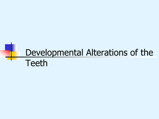 Developmental Alterations of the
Teeth
 