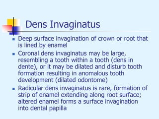 Dens Invaginatus
 Deep surface invagination of crown or root that
is lined by enamel
 Coronal dens invaginatus may be large,
resembling a tooth within a tooth (dens in
dente), or it may be dilated and disturb tooth
formation resulting in anomalous tooth
development (dilated odontome)
 Radicular dens invaginatus is rare, formation of
strip of enamel extending along root surface;
altered enamel forms a surface invagination
into dental papilla
 
