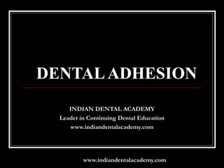 DENTAL ADHESION
     INDIAN DENTAL ACADEMY
  Leader in Continuing Dental Education
     www.indiandentalacademy.com




          www.indiandentalacademy.com
 