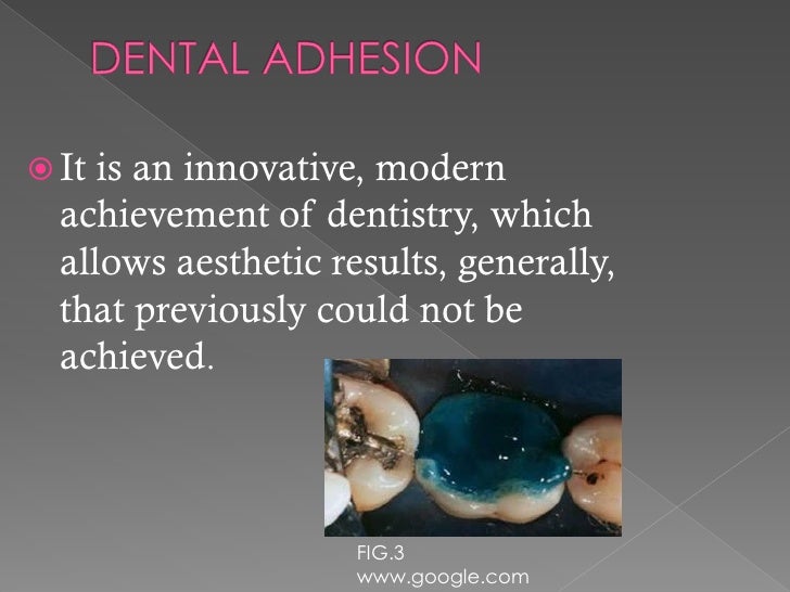 Dental adhesives