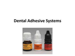 Dental Adhesive Systems
 