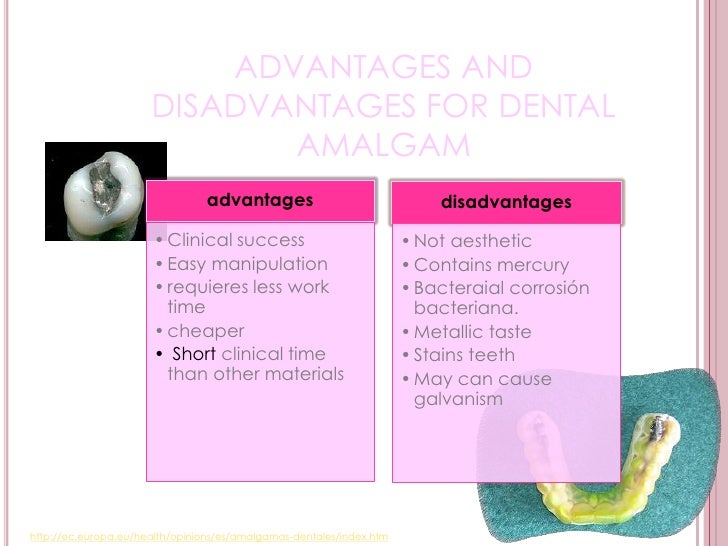 Dental amalgam