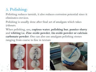 5. Polishing:
Polishing reduces tarnish, it also reduces corrosion potential since it
eliminates crevices.
Polishing is usually done after final set of amalgam which takes
24hours.
When polishing, use, copious water, polishing bur, pumice slurry
and whiting i.e. Zinc oxide powder, tin oxide powder or calcium
carbonate powder. One can also use amalgam polishing stones
ranging from coarse to fine in texture
 