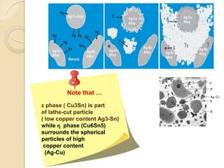Note that …
ε phase ) Cu3Sn) is part
of lathe-cut particle
( low copper content Ag3-Sn)
while h phase (Cu6Sn5)
surrounds the spherical
particles of high
copper content
(Ag-Cu)
 