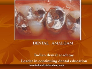 Dental amalgam

      DENTAL AMALGAM

       Indian dental academy
Leader in continuing dental education
    www.indiandentalacademy.com
 