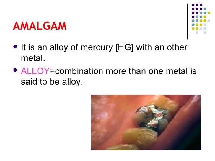 Dental amalgam