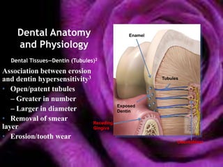 Dental Anatomy                         Enamel

     and Physiology
  Dental Tissues—Dentin (Tubules)2
Association between erosion
and dentin hypersensitivity3                         Tubules

• Open/patent tubules
   – Greater in number
                                        Exposed
   – Larger in diameter                 Dentin
• Removal of smear           Receding
layer                        Gingiva

• Erosion/tooth wear
                                                           Odontoblast
 