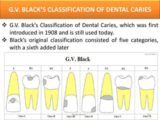 Dental Anatomy | PPTX