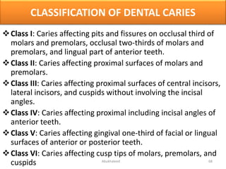 Tooth Case Classification Dental Anatomy | PPTX