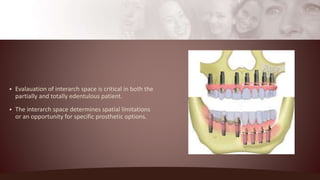 Dental and Maxillofacial Implants | PPTX