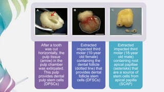 Dental and orofacial mesenchymal stem cells in craniofacial | PPTX
