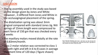 Dental and Skeletal changes after intraoral molar distalization with ...