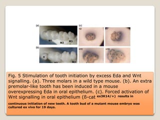 Dental anomalies and Genetics | PPTX