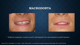Dental anomalies and its prosthetic implications.pptx