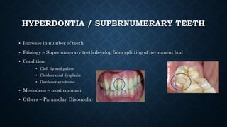 Dental anomalies and its prosthetic implications.pptx