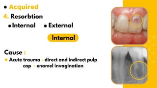 Dental Anomalies & Final Edition.pdf by Alsayed | PDF
