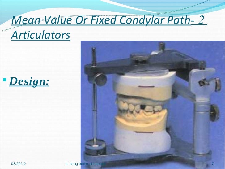 Dental articulators