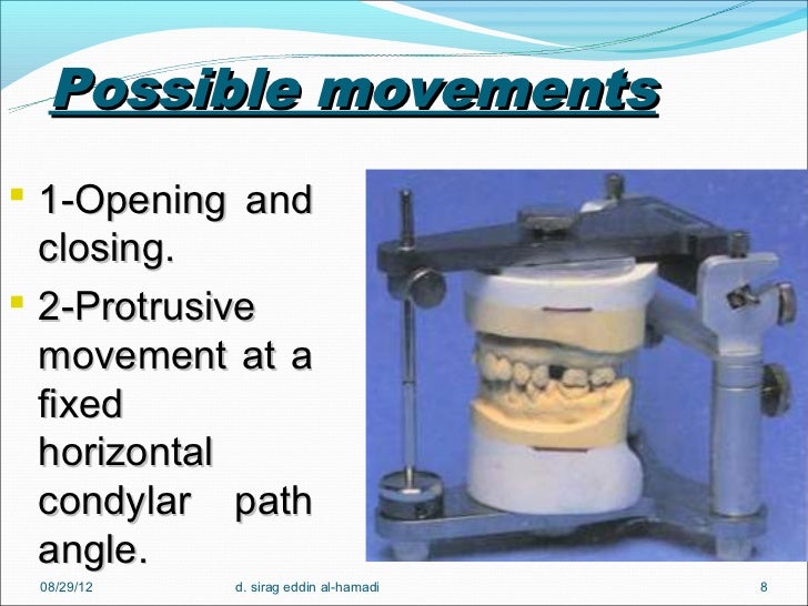 Dental articulators