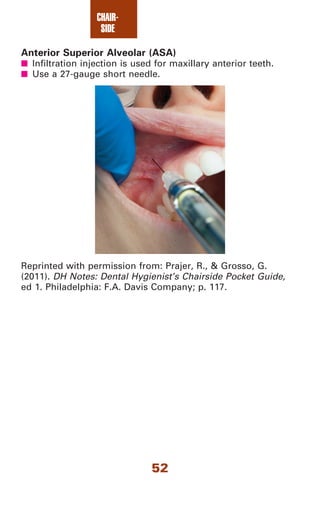 Dental assisting notes dental assistant's chairside pocket guide, 1 e ...