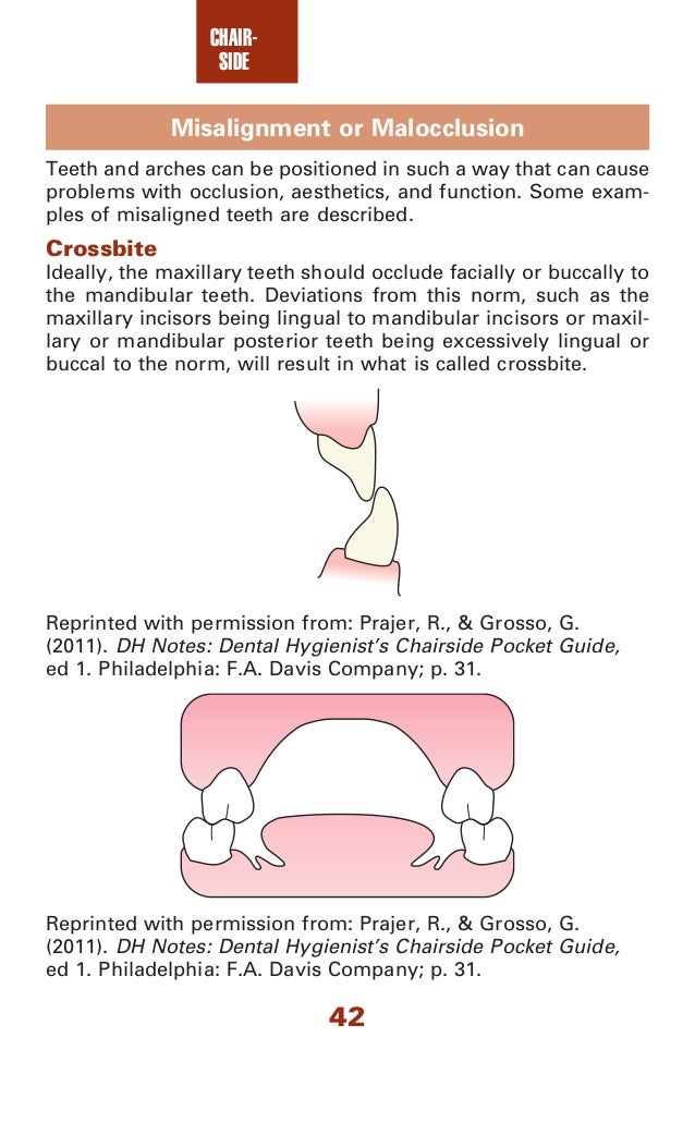Dental assisting notes dental assistant's chairside pocket guide, 1…