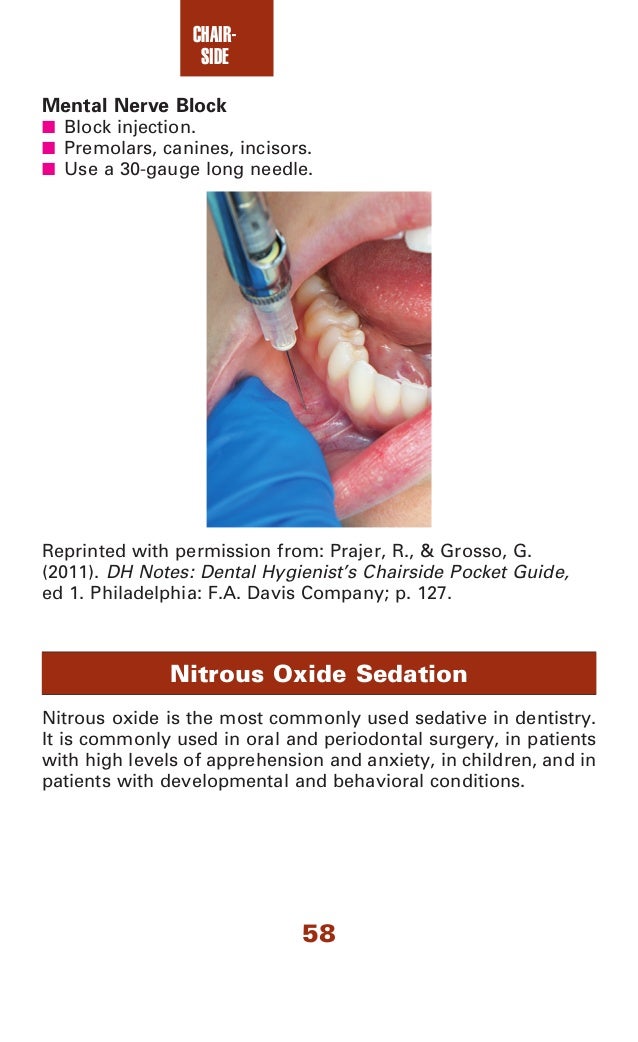 Dental assisting notes dental assistant's chairside pocket guide, 1…
