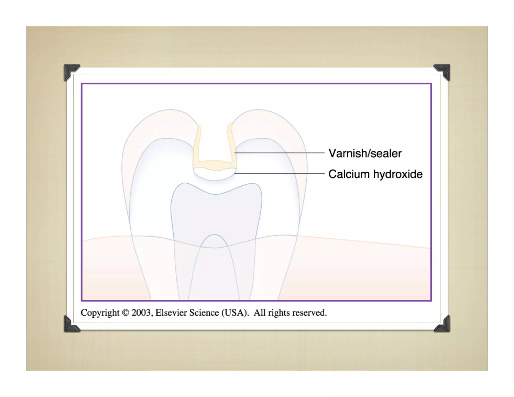 Dental bases and liners | PDF