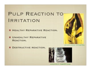 Pulp Reaction to
Irritation
Healthy Reparative Reaction.
Unhealthy Reparative
Reaction.
Destructive reaction.
course.jnu.edu.cn/.../Images/tth/21_bb.jpg
www.medicine.uiowa.edu/.../unit1/image/i-68.jpg
 