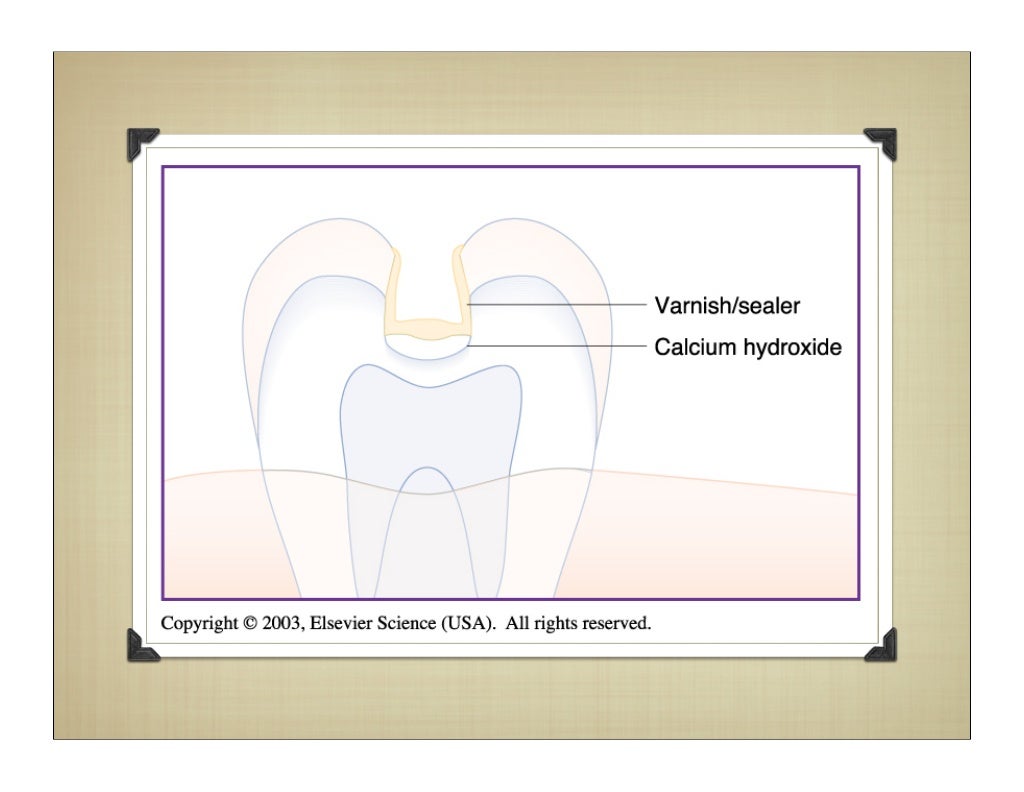 Dental bases and liners
