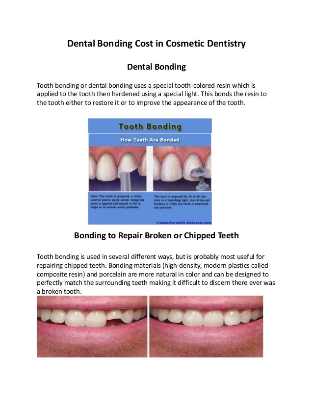 dental bonding cost in cosmetic dentistry dental bonding cost