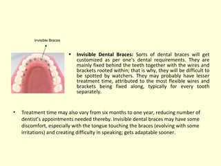 • Invisible Dental Braces: Sorts of dental braces will get 
customized as per one’s dental requirements. They are 
mainly fixed behind the teeth together with the wires and 
brackets rooted within; that is why, they will be difficult to 
be spotted by watchers. They may probably have lesser 
treatment time, attributed to the most flexible wires and 
brackets being fixed along, typically for every tooth 
separately. 
Invisible Braces 
• Treatment time may also vary from six months to one year, reducing number of 
dentist’s appointments needed thereby. Invisible dental braces may have some 
discomfort, especially with the tongue touching the braces (evolving with some 
irritations) and creating difficulty in speaking; gets adaptable sooner. 
 