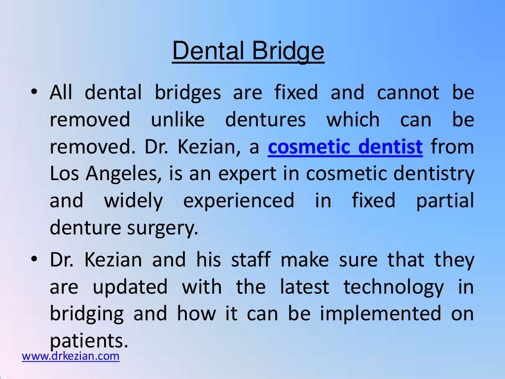 Dental bridge 1214