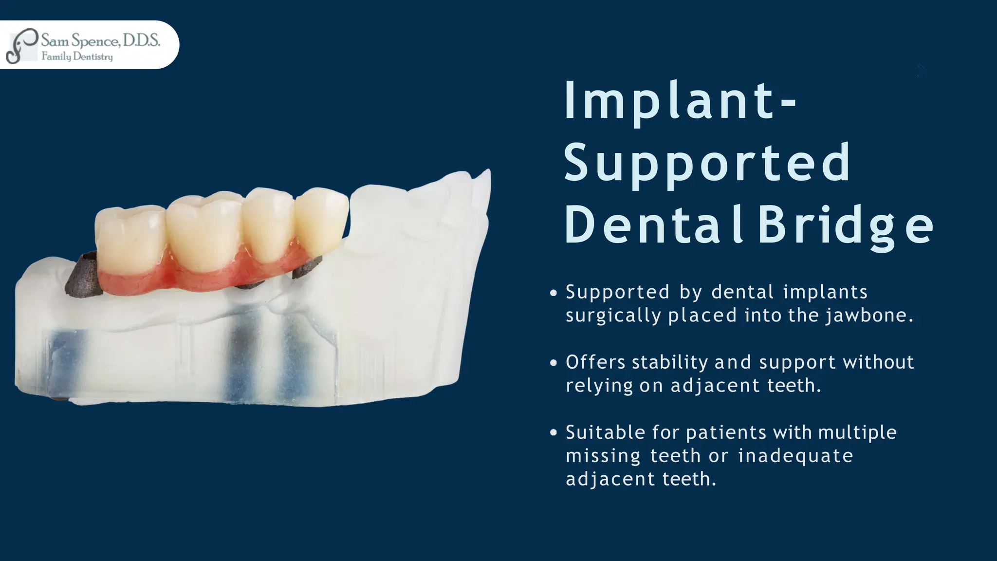 Implant-
Supported
Denta l Bridg e
Supported by dental implants
surgically placed into the jawbone.
Offers stability and support without
relying on adjacent teeth.
Suitable for patients with multiple
missing teeth or inadequate
adjacent teeth.
 